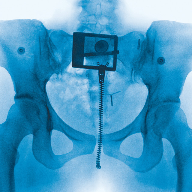 کاور آهنگ Man Of The Year از Lorde