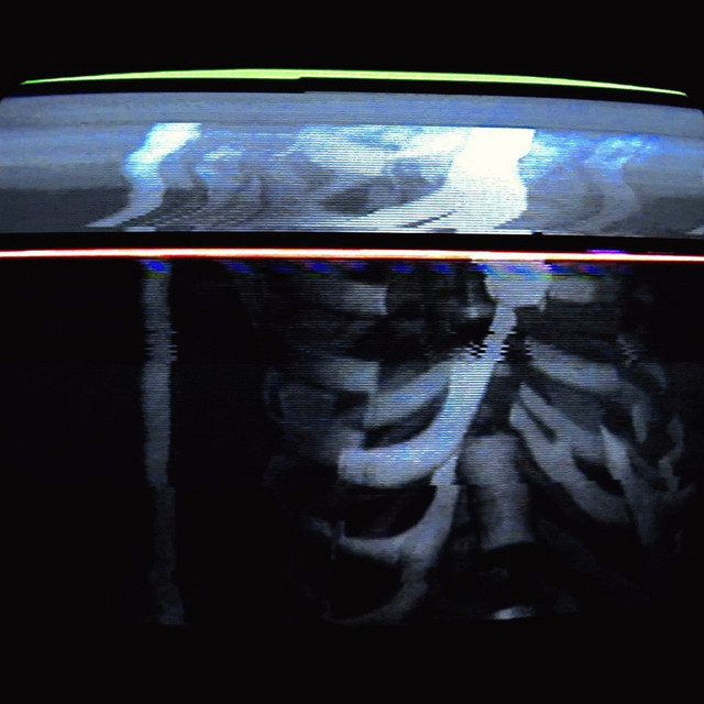 کاور آهنگ BlastZone (ZonaPorazheniya) از BONES
